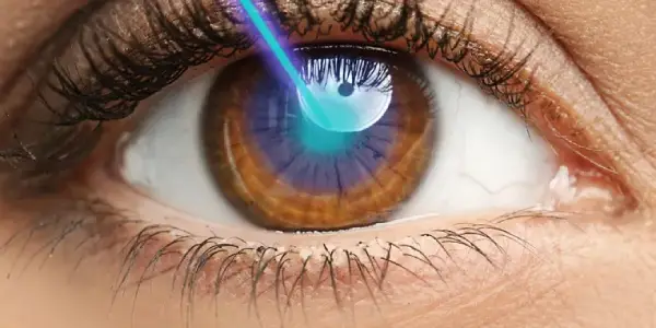 Cornea Procedures Corneal Surgery in Iran