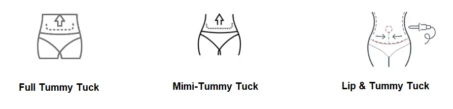 Tummy Tuck Techniques1